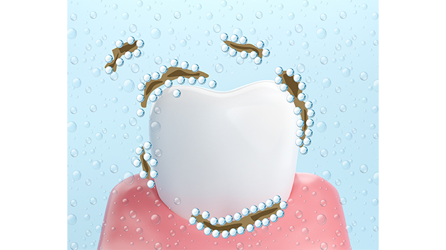 ウルトラファインバブルクリーニングが歯に付着している汚れを除去