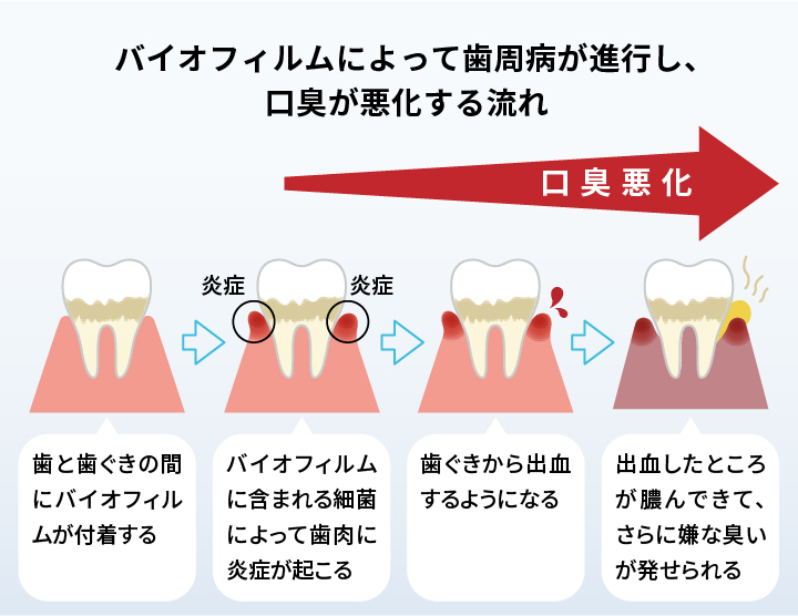 ホワイトニング用歯磨き粉