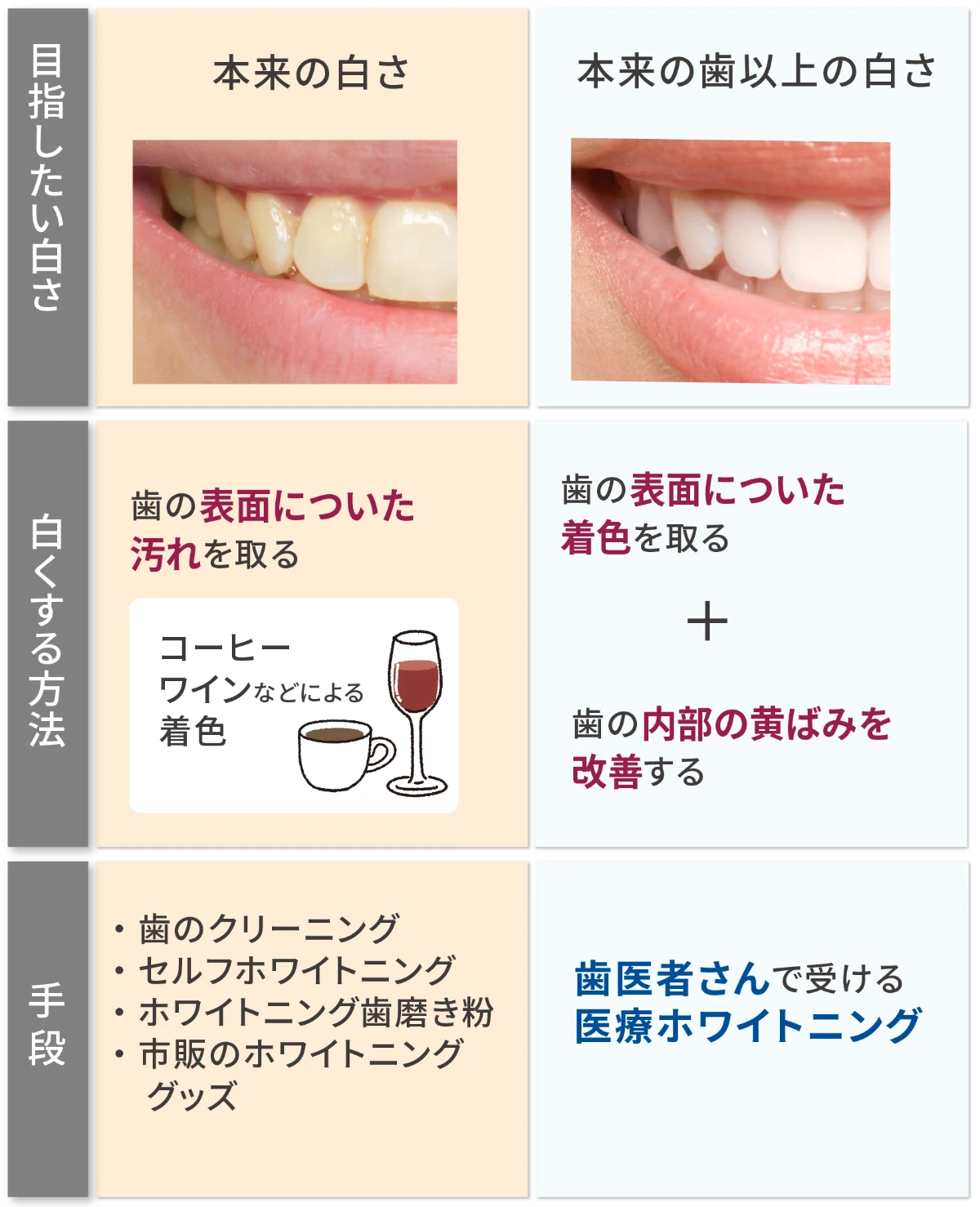 目指したい白さ・歯を白くする方法・歯を白くする手段に関する比較表 