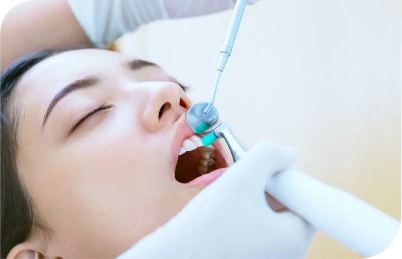 歯のクリーニングを受ける女性の画像