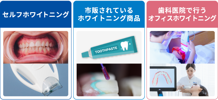セルフホワイトニング、ホワイトニング用の歯磨き粉や自宅でできるホワイトニンググッズ、歯医者さんで行う医療のホワイトニング