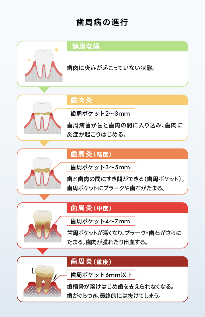 ホワイトニング用歯磨き粉