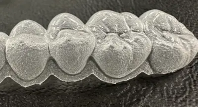 一般的なマウスピースのイメージ
