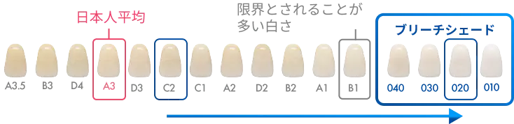 040以上の白さへ