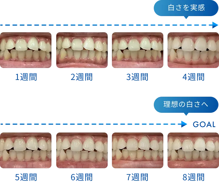 4週間で白さを実感、8週間で理想の白さへ