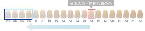 日本人の平均的な歯の色