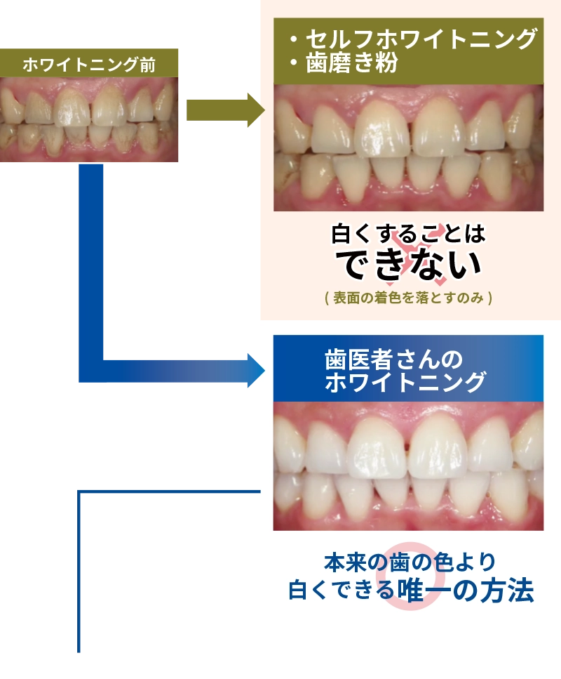 ホワイト二ング