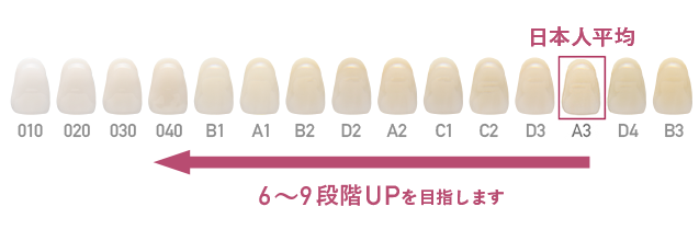 一度で白さ実感オフィスホワイトニング ホワイトエッセンス