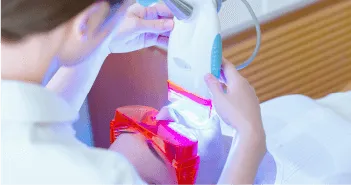 オフィスホワイトニングの料金