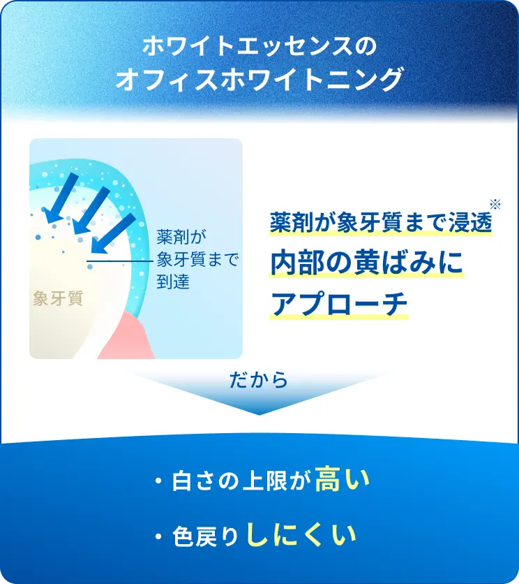 ホワイトエッセンスのオフィスホワイトニング：白さの上限が高い、色戻りしにくい
