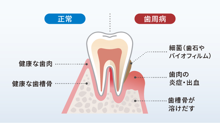 ホワイトニング用歯磨き粉