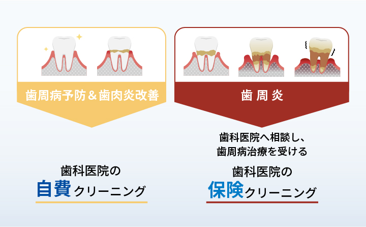 歯の色が黄ばんで見える理由を説明した画像