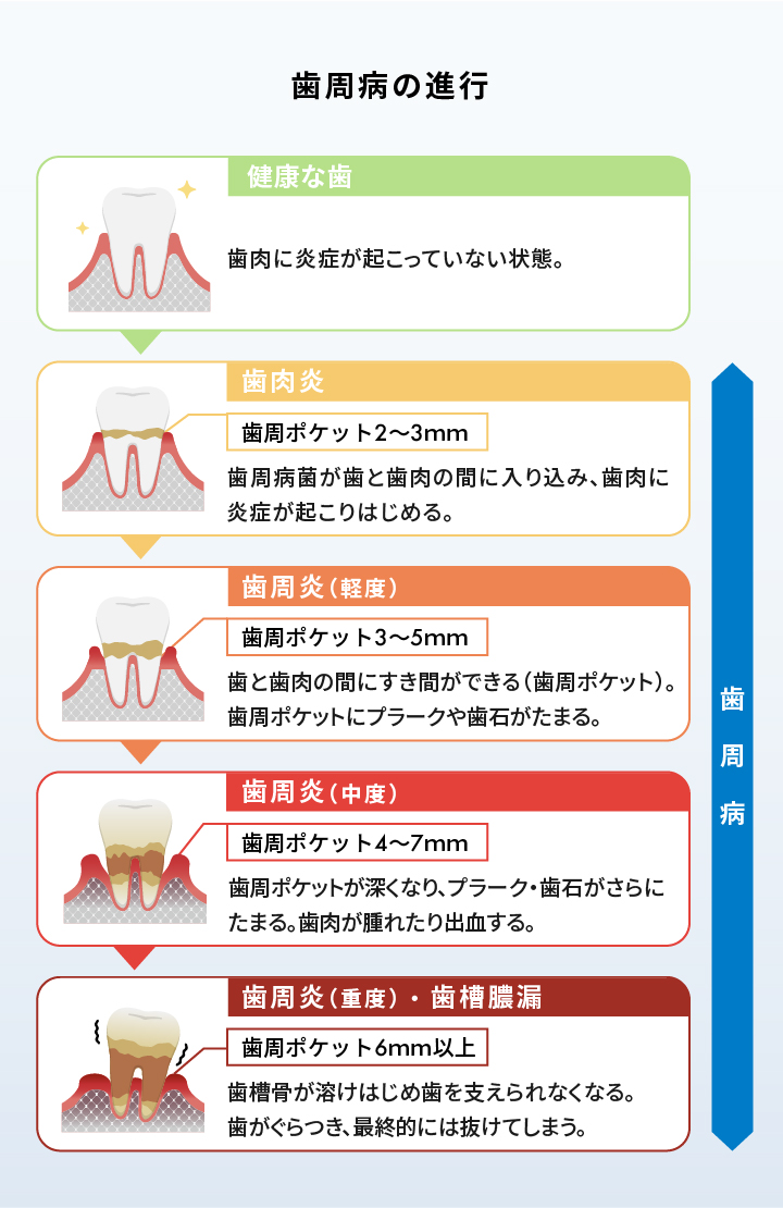 ホワイトニング用歯磨き粉