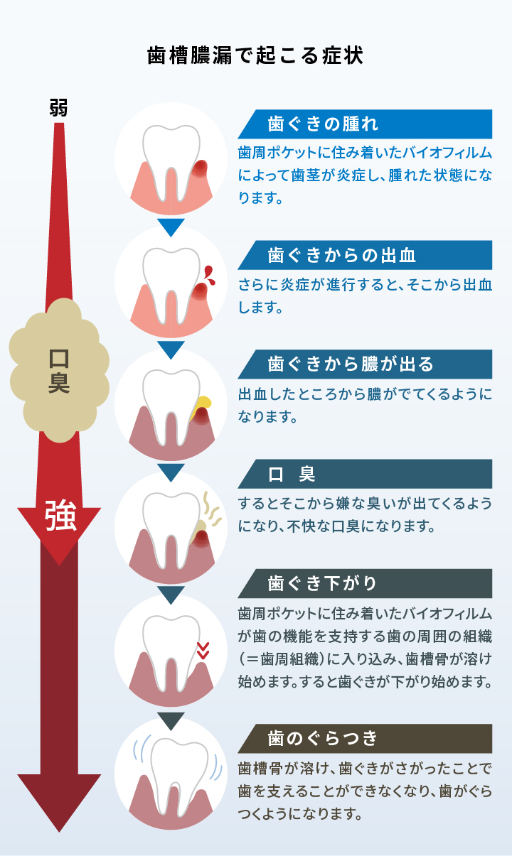 ホワイトニング用歯磨き粉