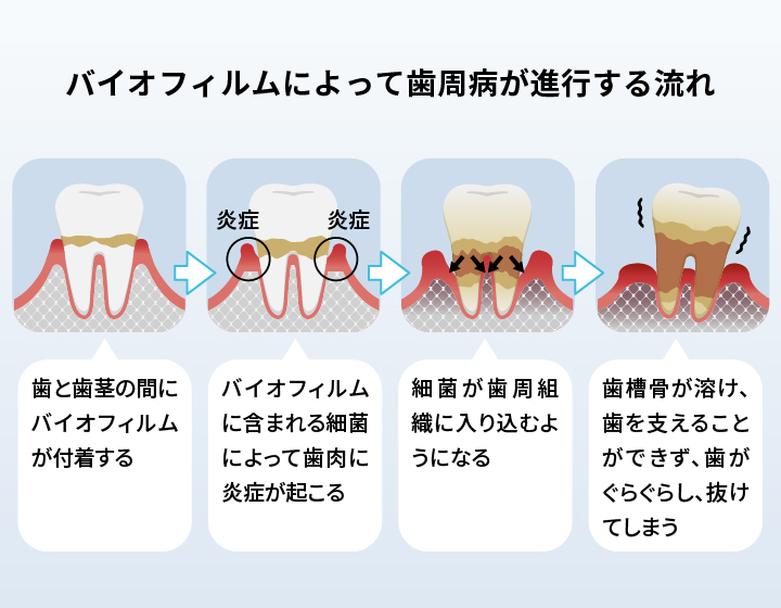 歯の色が黄ばんで見える理由を説明した画像