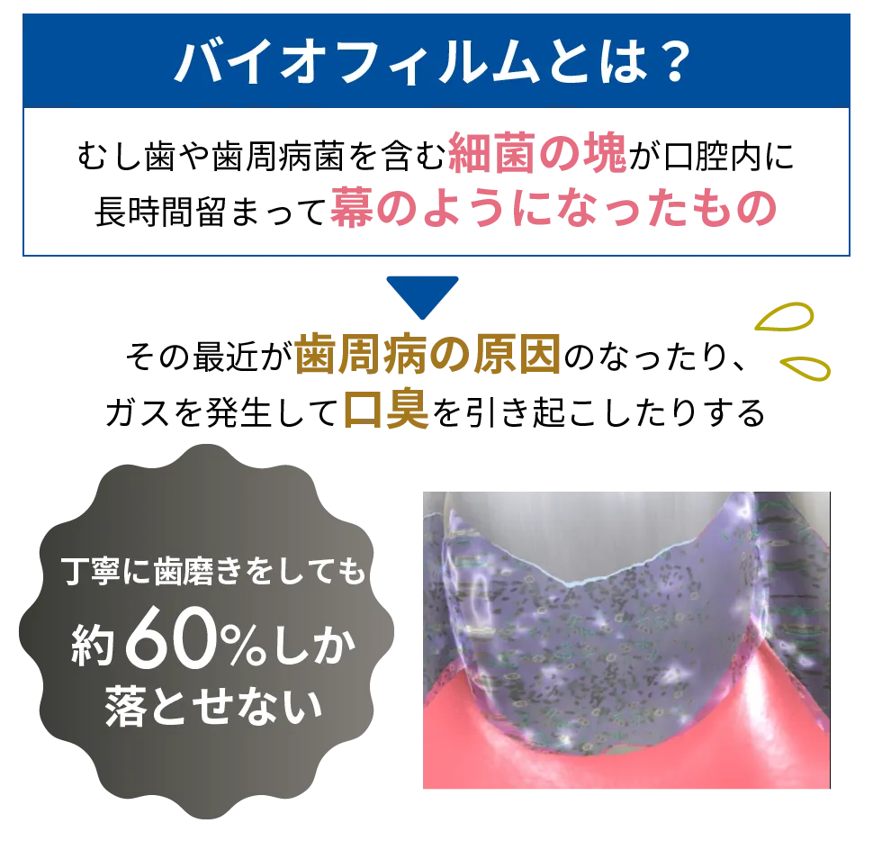 バイオフィルムとは虫歯や歯周病菌を含む細菌の塊が口腔内に長時間とどまって膜のようになったもの
