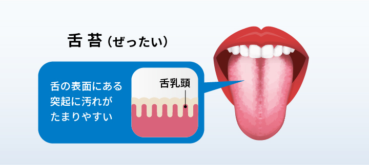 セルフホワイトニング、ホワイトニング用の歯磨き粉や自宅でできるホワイトニンググッズ、歯医者さんで行う医療のホワイトニング