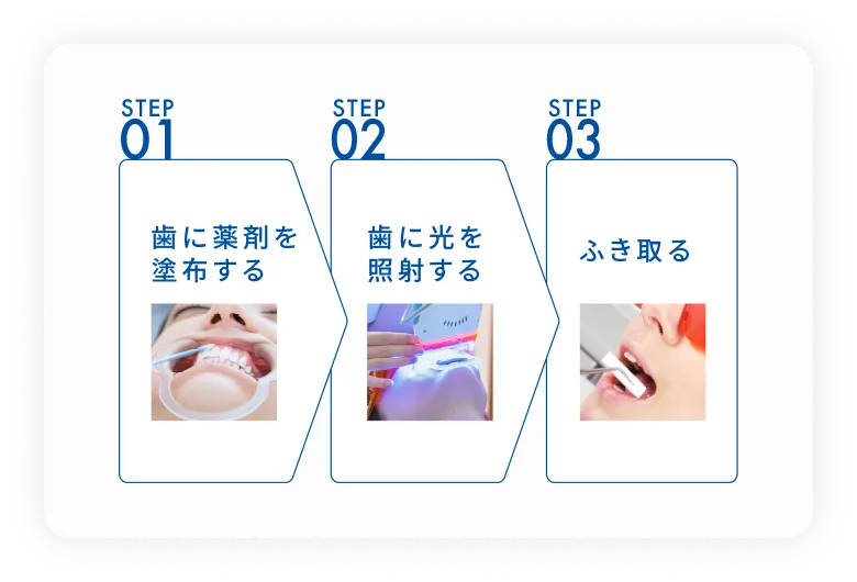 STP01 歯に薬剤を塗布する　STEP02 歯に光を照射する　STEP03　ふき取る