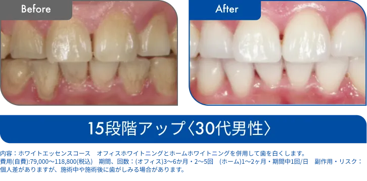 ビフォーアフター