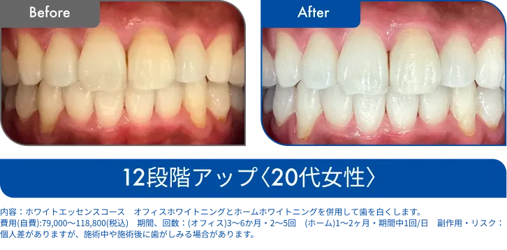 ビフォーアフター