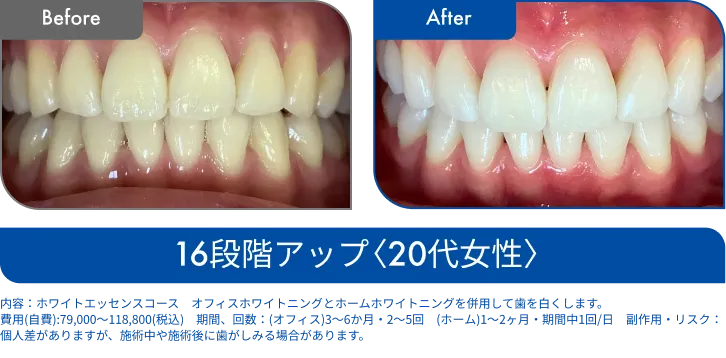 ビフォーアフター