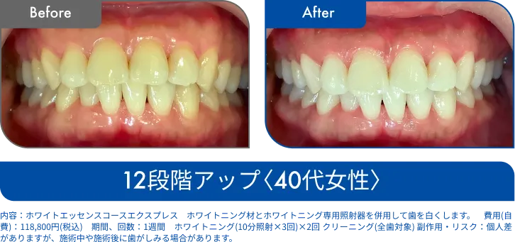 ビフォーアフター