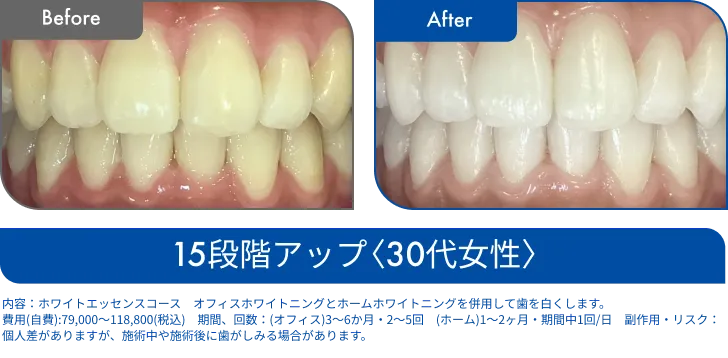 ビフォーアフター